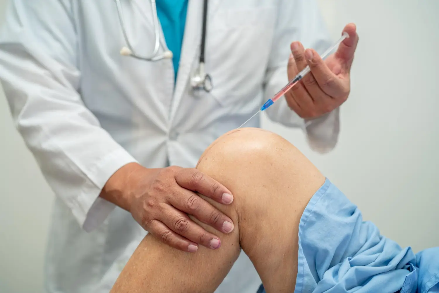 Platelet-Rich Plasma for Knee Arthritis – Clifton, NJ