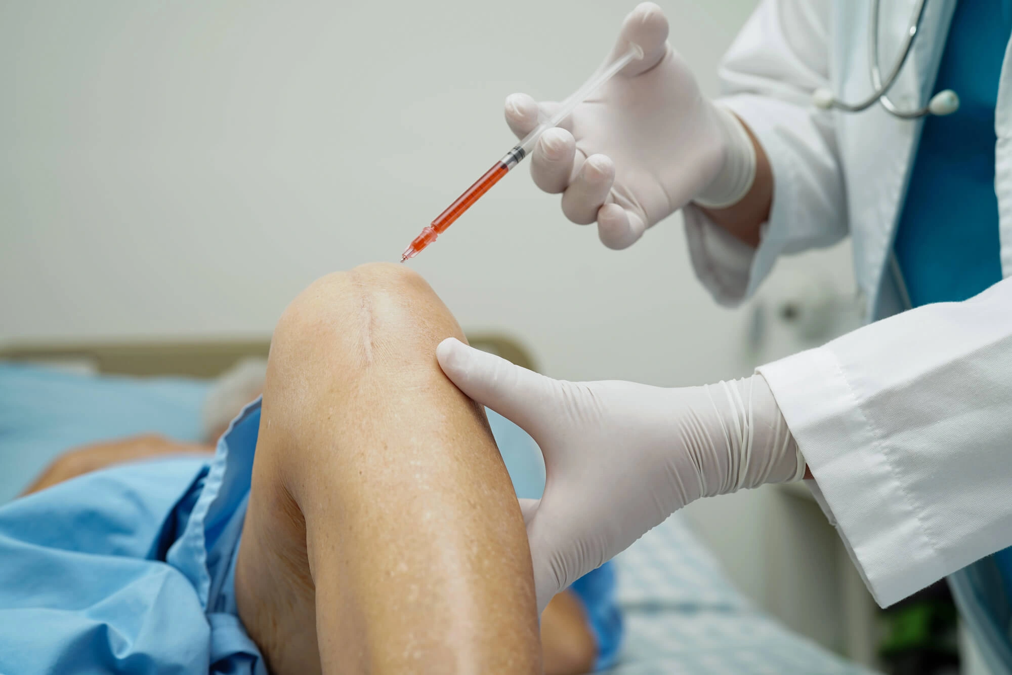 Living With Arthropathy: Why Joint Pain Gets Worse Over Time—and What You Can Do About It 